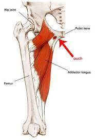 Female groin muscle anatomy muscles in female groin region muscles tendons ligaments groin female female groin muscle pull. Pin On Rightpain
