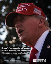 Officials say President Trump's "big, beautiful bill" could mean lost  health insurance, longer ER lines and higher taxes for Minnesotans. Full  story: https://cbsloc.al/3GqEqTK