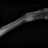 Skin cancer, bone cancer, and internal cancers claim the lives of many dogs. Https Encrypted Tbn0 Gstatic Com Images Q Tbn And9gcr Ghsksegkroqcrteuhdhcxpbqwuwgb Sbet6fvflixsggfe V Usqp Cau