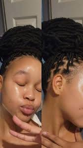 Where are the women that have rough skin? Follow Chineye Cynthia Ogbonna I  want to teach you how to clear your rough skin for free.