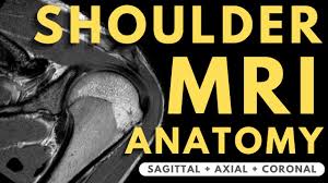 Image result for Shoulder MRI
