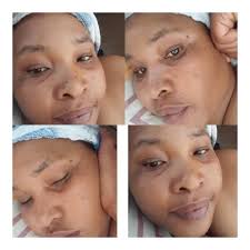 Hi does anyone know if I can change my face.. meaning taking the freckles  off?