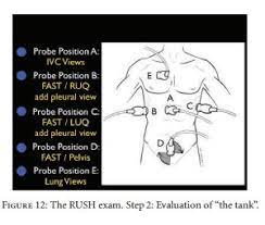 The rush protocol is to medical patients what the efast exam is to trauma patients. The Best Article On The Rush Ultrasound Exam For Medical Shock Tom Wade Md