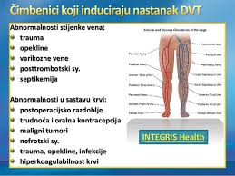 V prípade tepnovej (artériovej) trombózy tak dochádza k ischémii (nedokrveniu) časti tela. Duboka Tromboza Vena Dtv