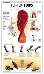 Pin On Foot Pain