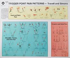 Trigger Points Of Pain Wall Charts Set Of