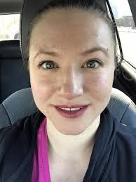 I just got fillings done in my front teeth, so my upper lip is numb, and I  feel like the 2-faced girlfriend 🤣