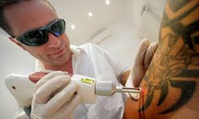 Business hours may be different today. Tattoo Removal Business Booming As Inked Job Seekers Willing To Pay Top Dollar And Bear Searing Pain To Get Hired Daily Mail Online