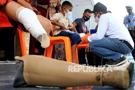 Murah, praktis, dan mudah diperbaiki itu kaki palsu sugeng. Tni Au Berikan Bantuan Kaki Prostetik Bagi Penyadang Difabel Republika Online