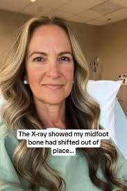 How to Fix A Lateral Foot Xray