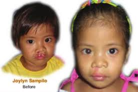 one child at a time Faces