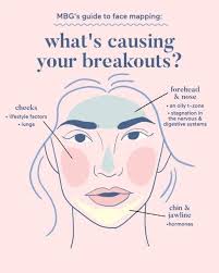 Acne Body Mapping Zones Skin Care In 2020 Pimples On Face Face Mapping Acne Acne Mapping