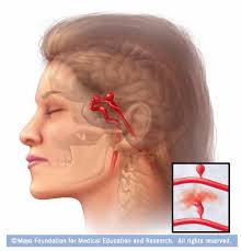 Acestea sunt, de obicei, cauzate de muschii incordati, vasele de sange dilatate, modificarile aparute in comunicarea dintre partile instalarea lenta a durerii de cap. Ø§Ù„ÙˆØ²ÙŠØ± Ø§Ù„Ø£ÙˆÙ„ Ù„ÙŠØ¹Ø§Ù‚Ø¨ Ù‚Ø§Ø¦Ù…Ø© Ø§Ù„Ù…ØµØ·Ù„Ø­Ø§Øª Durerea De Cap La Ceafa Outofstepwineco Com