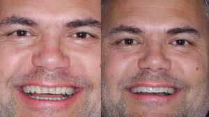 Gustavo Dos Santos (@gustavo.santos.dr) • Instagram photos and videos