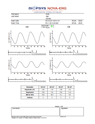 Diopsys Nova Erg Report Certs Exam Time Perg