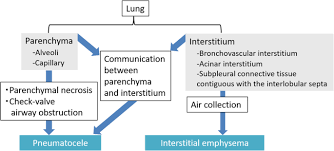 Maybe you would like to learn more about one of these? Thoracic Abnormal Air Collections In Patients In The Intensive Care Unit Radiograph Findings Correlated With Ct Insights Into Imaging Full Text