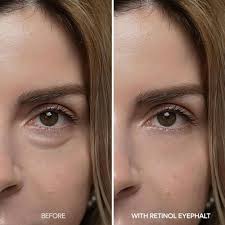 Dr.Melaxin Eyephalt Retinol Eyebag ...