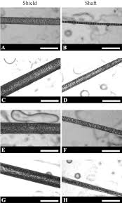 Light Micrographs Of Medulla Structures From Rodentia Hair Shafts And Download Scientific Diagram