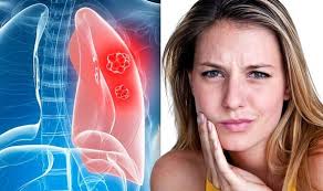 You may think it's irrelevant, but chronic shoulder pain can sometimes be the result of a tumor that is pressuring the nerves in the armpit, leading to tingling sensations, aches, and shooting. Lung Cancer Symptoms The Sign On Your Face That You Might Not Recognise Magdelaine Net