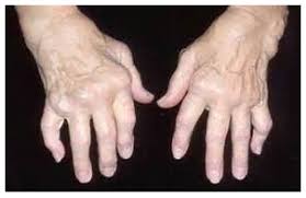 images?q=tbn:ANd9GcRG-4si2Yxd6xyTradrVmM7fPdD08c7gQVV9Q&s