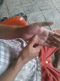 Nyeri dada adalah kondisi ketika dada terasa seperti tertusuk, perih, atau tertekan.nyeri ini bisa terjadi di dada sebelah kanan, sebelah kiri, atau dada tengah. Self Healing Tips Mengobati Nyeri Dada Dalam 10 Menit Halaman All Kompasiana Com