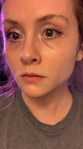 Eye cream for tear trough lines and creases