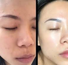 ✓Dhc Vitamin C and Vitamin B2* ✓Japan Authentic,scan pawp pawp ngam*  ✓Vitamin C 1000mg lai anih bakah Vitamin B2 a tel bawk* ✓Vitamin C hi kan  hriselna atan a that mai bakah