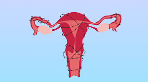 We did not find results for: The Four Different Stages Of Endometriosis Explained Sheknows
