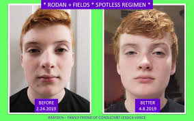 Jessica Vance: Rodan + Fields Independant Consultant