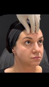 🎉Excited to finally share... I've been selected as one of 16 providers  across the country for the MD Codes™ Mentorship Program with  @mauriciodemaio and the @allergan_medical_institute ., This program ...