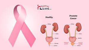 Despite this, pancreatic cancer is among the deadliest types of cancer, which is why it's extremely important to know and recogni. Prostate Cancer In Hindi à¤ª à¤° à¤¸ à¤Ÿ à¤Ÿ à¤— à¤° à¤¥ à¤® à¤¹ à¤¨ à¤µ à¤² à¤• à¤¸à¤° à¤¸ à¤• à¤¸ à¤•à¤° à¤¬à¤š à¤µ