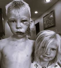 Repost @nicolenoelwalker On July 9th, my six year old nephew Bridger saved  his little sister's life by standing between her and a charging dog. After  getting bit several times