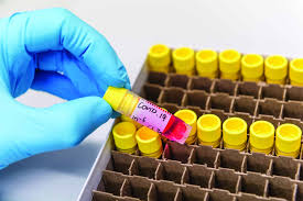 Nvax shares up 1058.54% ytd on vaccine hopes, cepi backing. M A Race For A Covid 19 Vaccine