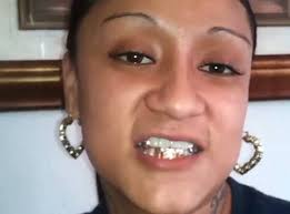 Gold Grills by flocca