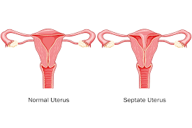 Image result for uterus