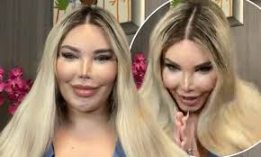 Jessica, 37, spoke exclusively to mailonline after the operation, revealing she is recovering at a facility in antalya and losing 'one kilo per day' while 'only consuming detox drinks'. Jessica Alves Delighted With Vagina After Sex Reassignment Surgery Daily Mail Online