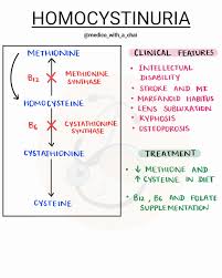 Image result for Homocystinuria