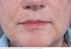 Image result