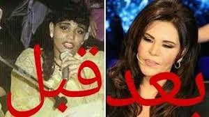 ياسمين علقت على الصورة، التي نشرتها على الفيسبوك قائلة: ÙŠØ§Ø³Ù…ÙŠÙ† Ø§Ù„Ø®Ø·ÙŠØ¨ Ù‚Ø¨Ù„ Ø¹Ù…Ù„ÙŠØ§Øª Ø§Ù„ØªØ¬Ù…ÙŠÙ„ ÙˆØ¨Ø¹Ø¯Ù‡Ø§ Ø£ØºØ§Ù†ÙŠ Mp3 Ù…Ø¬Ø§Ù†Ø§