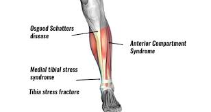 We did not find results for: Shin Pain Symptoms Causes Treatment Prevention