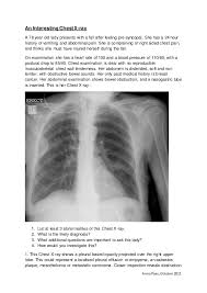 An Interesting Chest X Ray
