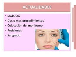 Manejo anestesico en cirugia plastica