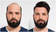 Image result