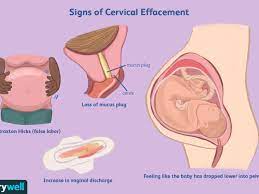 Cervical Effacement: Signs, Measurement, Complications