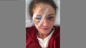 We did not find results for: Karolina Kowalkiewicz Przeszla Operacje Oka Powiedziala Jak Sie Czuje Polsat News