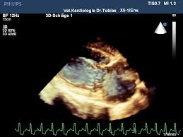 It is named after heinrich rudolf hertz. Pda Beim Hund Wenn Die Lokomotive Im Herzen Rauscht Hunderunden
