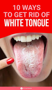 Maybe you would like to learn more about one of these? 10 Ways To Get Rid Of White Tongue And Make It Healthier White Tongue Tongue Sores Tongue Cleaner