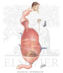 Image result for Adynamic Ileus