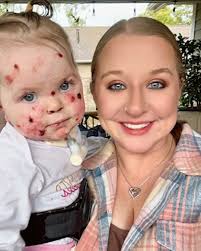 I have a warrior daughter with immense strength and amazing determination!”  💪✨ Born with Junctional Epidermolysis Bullosa (JEB), a rare and painful  genetic disorder, Brooklyn faces daily challenges with resilience. From  navigating