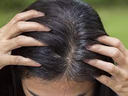 Hair follicles contain pigment cells that produce melanin, which gives your tresses their color. Grey Hair At 30 Home Remedies To Reverse The Problem Home Remedy To Get Rid Of Grey Hair